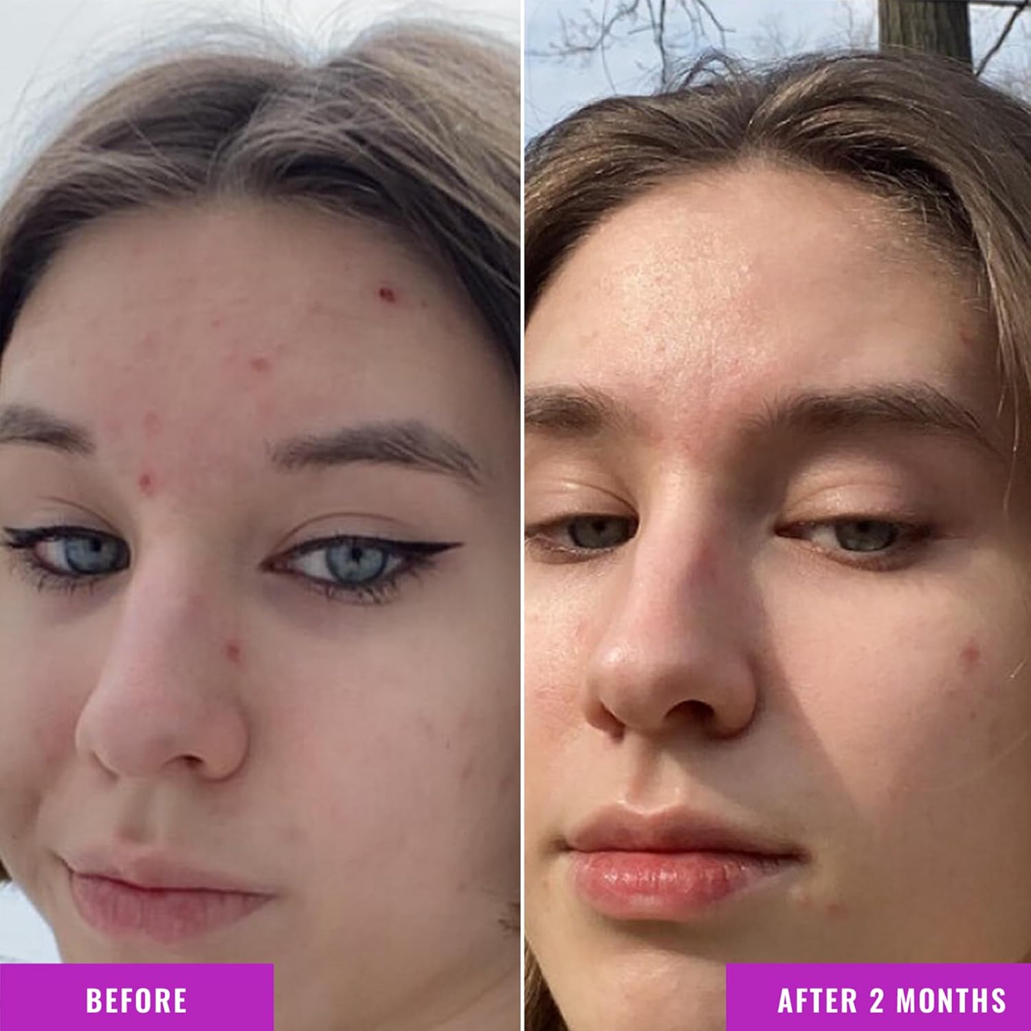 Good Molecules Niacinamide Serum – 10% Niacinamide to Target Blemishes, Nourishment, and Skin Tone – Ultra Hydrating Serum and Brightening Skin Care for Face - Image 3